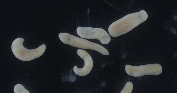 Freshwater Trematode Parasites: Clinostomum, Postorchigenes and Thapariella spp. for education in Lab.