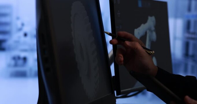 Close-up of a hand pointing at spine x-rays on dual computer screens in a dark medical setting, diagnosis, review