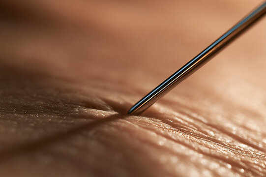 Ultra-macro photo of a steel needle tip touching human skin