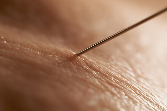 Ultra-macro photo of a steel needle tip touching human skin