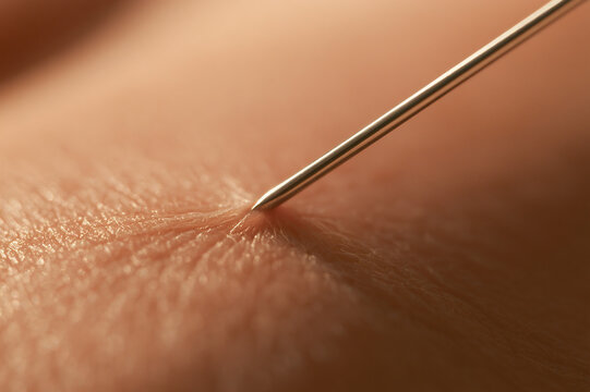 Ultra-macro photo of a steel needle tip touching human skin