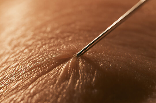 Ultra-macro photo of a steel needle tip touching human skin