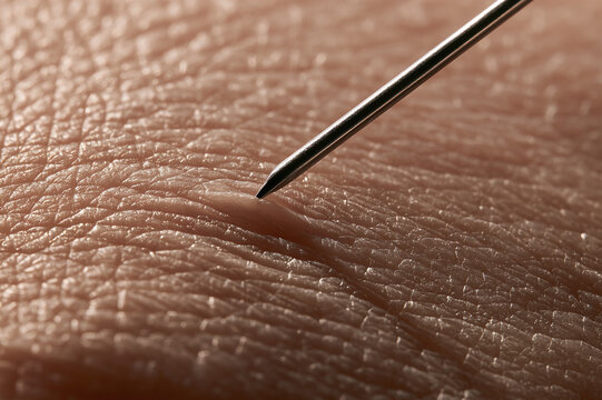 Ultra-macro photo of a steel needle tip touching human skin