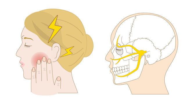 Comparison Diagram of white woman Experiencing Trigeminal Neuralgia and a Human Skull