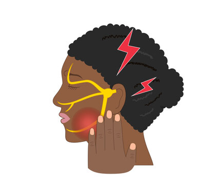 Profile Illustration of a Black  Woman with Trigeminal Neuralgia Feeling Facial Pain