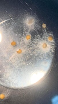fungal microscopy