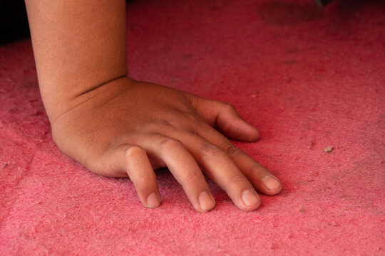 A child's hand placed against a pink or red textured surface. An inflammatory or viral rash that may appear as small bumps or a rash on the limbs.