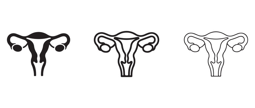 Medical anatomical views of the female uterus and ovaries with fallopian tubes