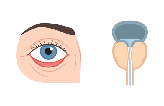 Medical illustration showing human eye conjunctivitis and prostate gland anatomy side by side