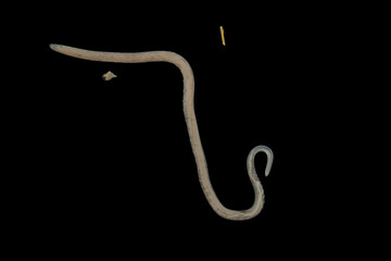 Fototapeta premium Scientific collection of freshwater trematode parasites, including Clinostomum spp., Postorchigenes sp., and Thapariella sp. These parasitic flatworms have complex life cycles involving multiple hosts