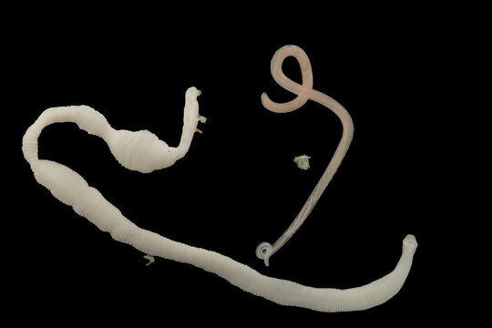 Scientific collection of freshwater trematode parasites, including Clinostomum spp., Postorchigenes sp., and Thapariella sp. These parasitic flatworms have complex life cycles involving multiple hosts