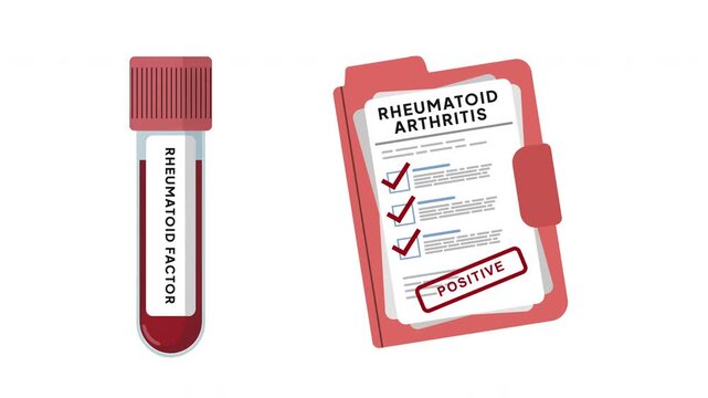Rheumatoid arthritis test animation showing a blood sample tube and positive medical report, representing rheumatoid factor testing, autoimmune disease screening and joint inflammation