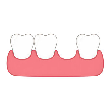 icon of a human gum line with one missing tooth