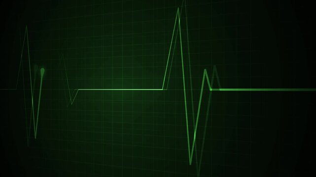 Heartbeat monitor line on a grid with a flat pulse and sharp spikes animation, showing a medical emergency or heartbeat concept