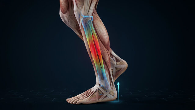 Anatomical 3D render of human leg muscles, shin splints pain illustration, lower leg muscular structure with colorful heat map