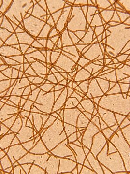 Microscopic view of branching fungal hyphae and mycelium shown in a scientific potrait for educational presentations, laboratory research, and medical textbooks.