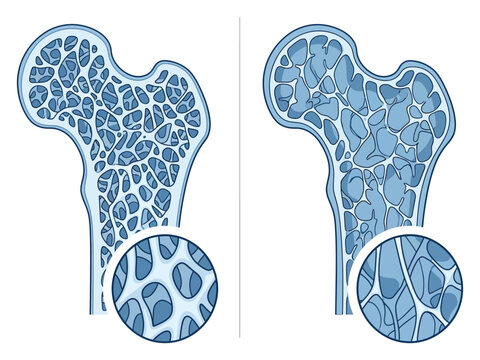 Spongy bone structure and compact bone comparison illustration Vector
