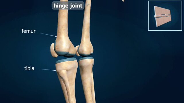 Hinge joint