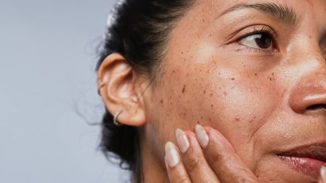 Hispanic young woman applying skincare serum from pipette onto freckled cheek, massaging liquid into skin, close up. Perfect for beauty product commercials