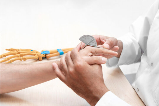 Physiotherapist measuring finger joint range of motion with goniometer during orthopedic hand rehabilitation assessment examination, focusing on arthritis, injury recovery, and physical therapy