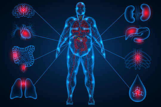 The impact of obesity and excess weight on key internal organs of a person. A person is connected to risk zones: the brain, heart, liver, kidneys, lungs, intestines, spine, and metabolic disorders.