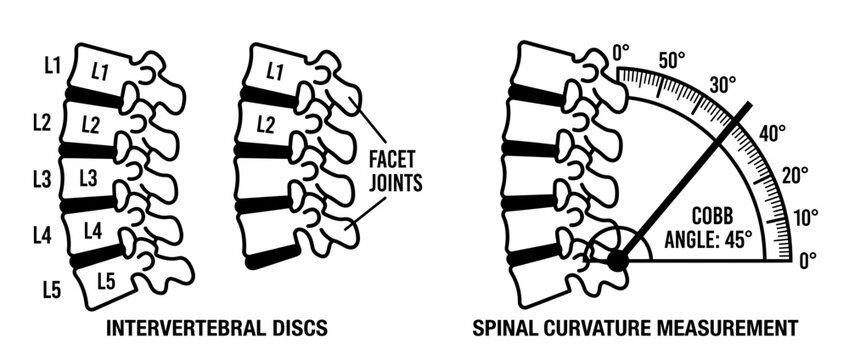 Spinal Anatomy and Curvature Measurement Illustration