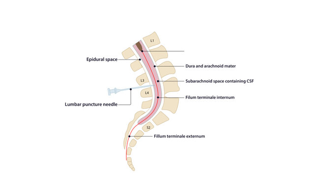Sagittal section  of spinal cord, Sagittal view showing the spinal cord, conus medullaris, filum terminale, and lumbar puncture site.