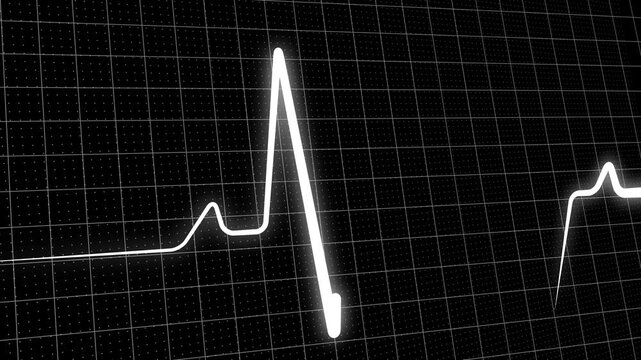 White heartbeat line animation pulses rhythmically across a dark grid. Medical monitor telemetry traces the heartbeat line animation. Vital cardiogram health data guides the heartbeat line animation.