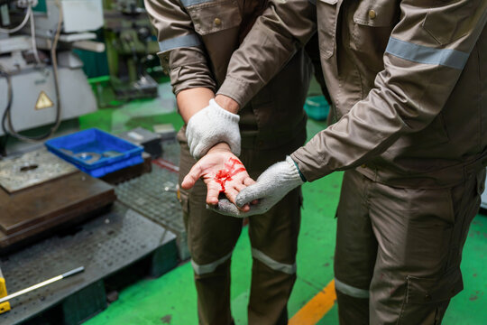 industrial accident with injured worker bleeding from hand in factory, worker showing bloody hand injury from machinery accident in workshop, workplace injury and first aid concept
