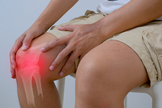 Knee pain and patellofemoral pain showing an inflamed kneecap with bone anatomy for orthopedic diagnosis treatment rehabilitation and sports medicine.