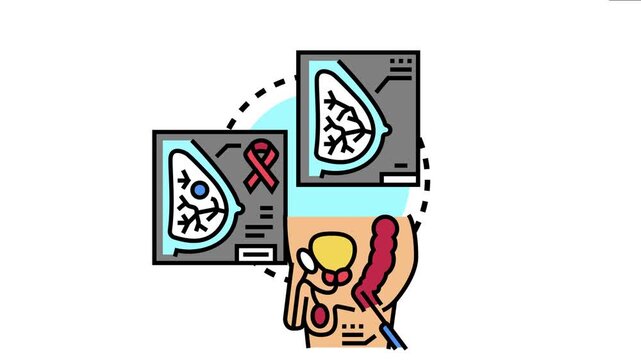 Cancer screening medical concept showing mammography for breast cancer and digital rectal exam for prostate cancer detection and prevention