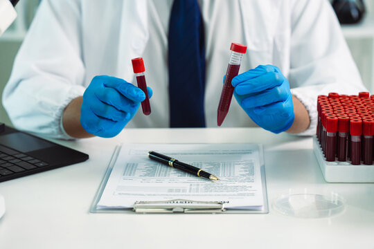 Scientist Holding Blood Sample Test Tube with Microscope and Rack of Blood Vials in Medical Laboratory