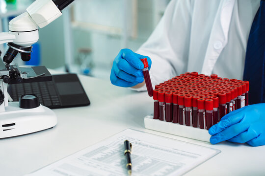 Scientist Holding Blood Sample Test Tube with Microscope and Rack of Blood Vials in Medical Laboratory