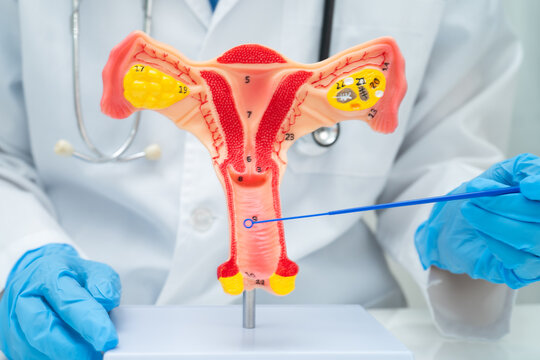 Doctor holding human uterus model for vaginal and cervix pap smear check up in the obstetrics and gynecology.