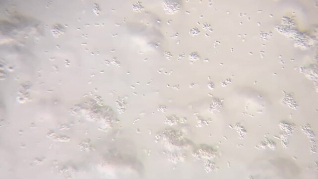 Yogurt bacteria under microscope: Lactobacillus bulgaricus and Streptococcus thermophilus probiotics 