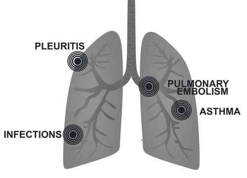 Lungs pain disorders. vector illustration