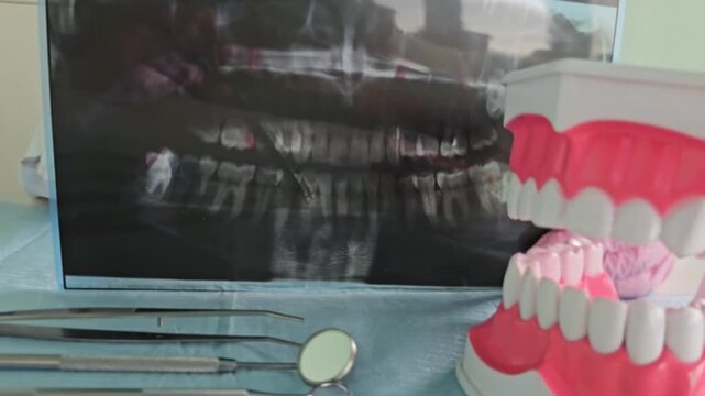 Understanding dental x-rays and oral health tools at a dental clinic