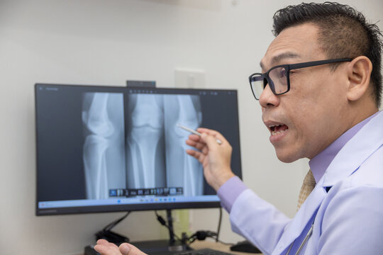 Doctor pointing on the knee problem point on x-ray film. x-ray film show skeleton knee on film. Surgery medical technology concept. Osteoarthritis in the elderly.