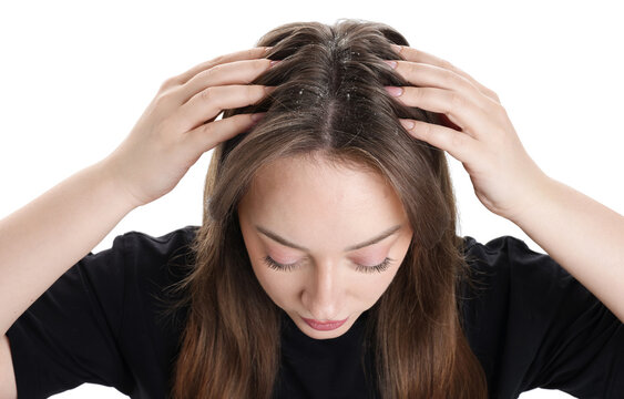 Dandruff problem. Woman examining her head on white background, above view