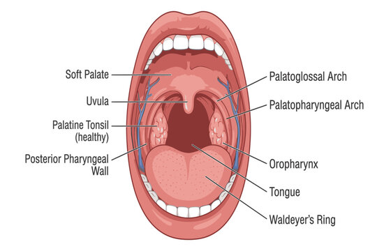 Educational infographic illustrating normal tonsil anatomy and their location within the healthy human throat and immune system.