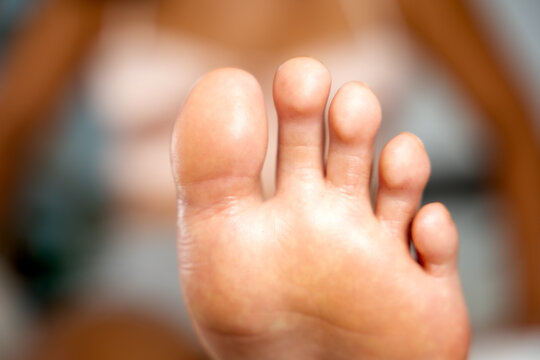 Person showing clean healthy foot and toes