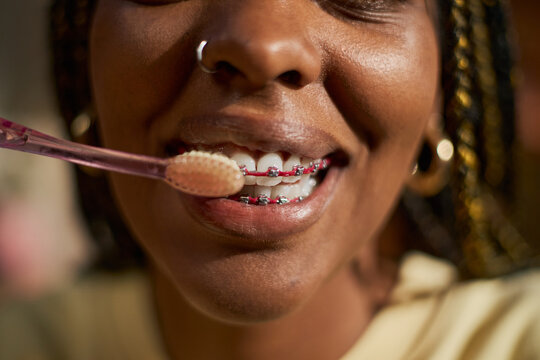 African American young woman with dental braces brushing teeth, promoting oral hygiene and orthodontic care. Image suitable for dental clinics and healthcare marketing, extreme close up