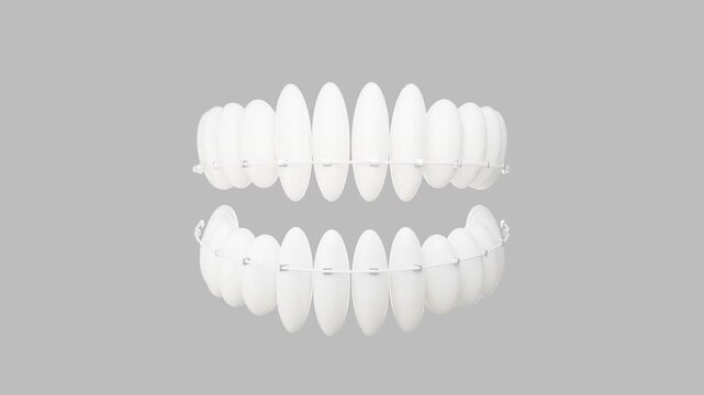 A set of white dental veneers displayed against a neutral gray background, showcasing.