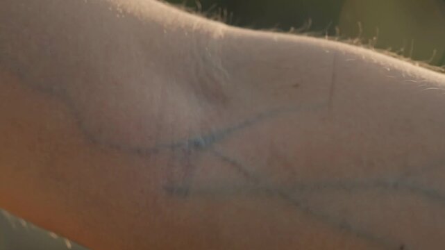 Extreme Macro of Forearm Blue Veins and Translucent Skin Hairs in Sunlit Detail