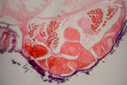 Microscopic view of human tissue section showing muscle fibers and connective tissue with distinct cellular structures and staining patterns under high magnification