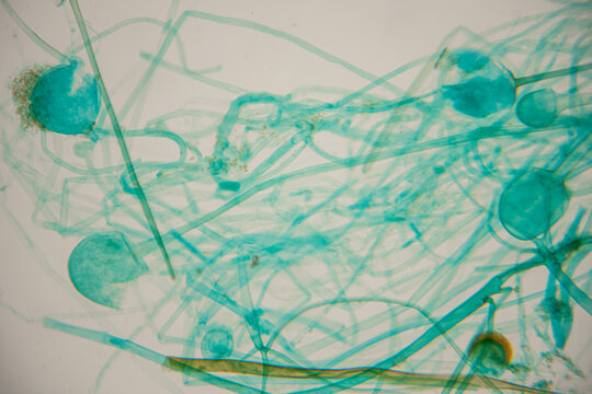 Microscopic view of blue-green algae with filamentous structures and spherical cells on a light background, showcasing intricate patterns and textures