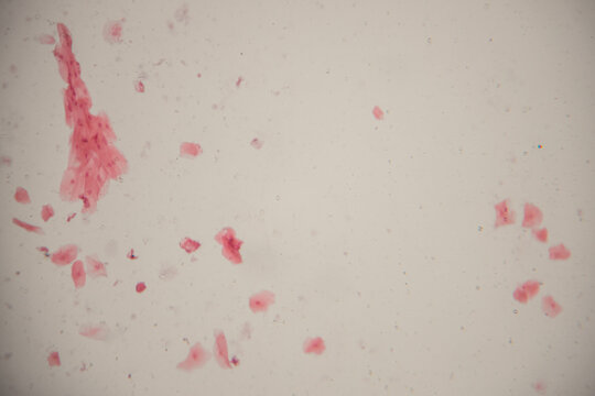 Microscopic view of pink-stained cellular material on a glass slide, showcasing various shapes and sizes of cells and fragments under laboratory conditions