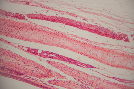 Microscopic view of human muscle tissue showing striations and cellular structures in shades of pink and purple, highlighting the intricate details of muscle fibers