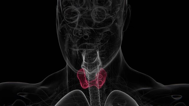 Thyroid nodules are abnormal lumps or growths within the thyroid gland that may be solid, fluid-filled, or a combination of both in 4K Video UHD