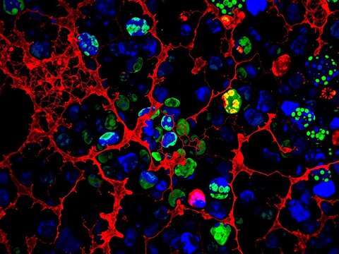 Microscopy image of protein localization in cell nucleus, protein localization, TPD